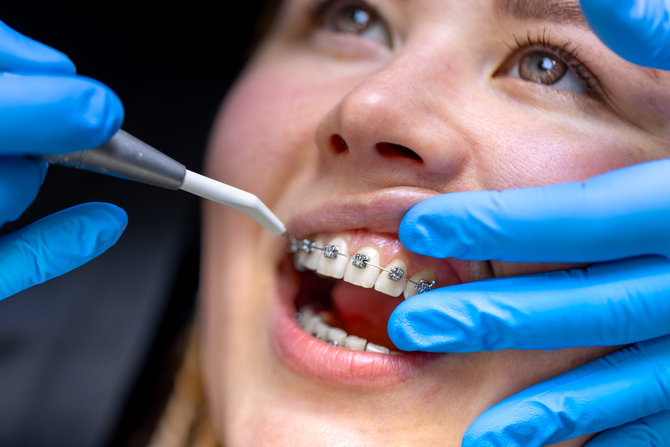 The Hidden Truth About Choosing Between an Orthodontist and a General Dentist for Your Perfect Smile Revealed!